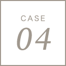 CASE04